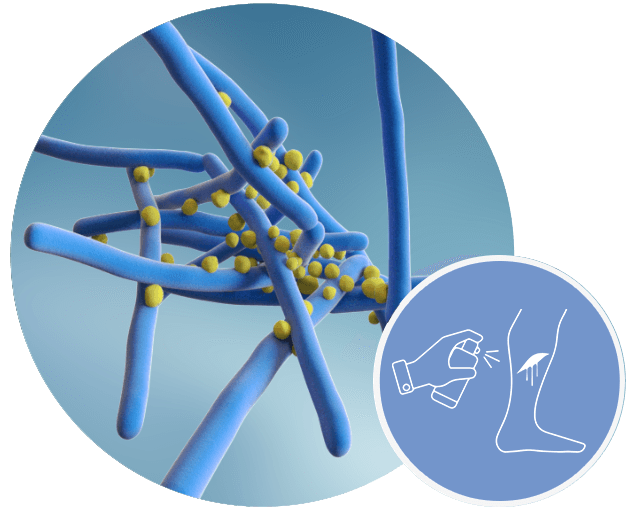 belano medical produkte mrsa wunde hygiene keim