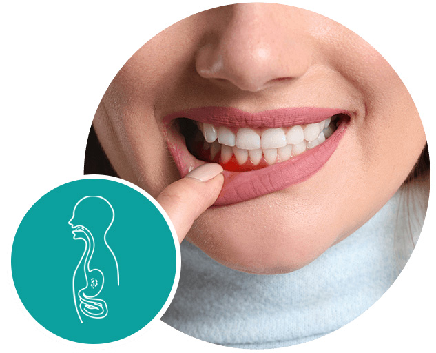 belano medical produkte mund parodontitis 1 ventrisana- mouth care products